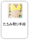 たるみ取り手術(腹部)