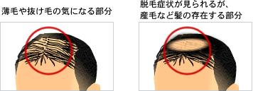 HARG�Ö@�̓K������