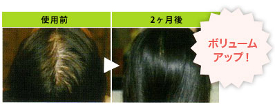 使用前 2ヶ月後 ボリュームアップ