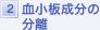 二重瞼