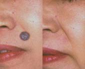 �ق��뎡�ÑO��