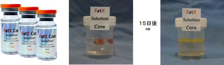 脂肪溶解注射（Fat X Core　ファットエックスコア）